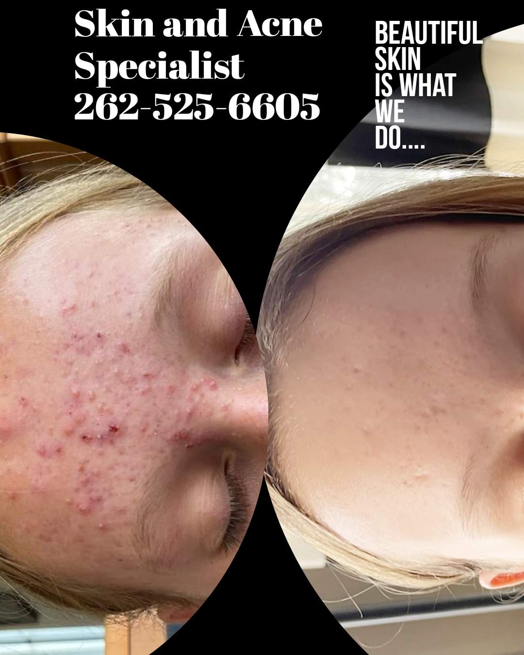 Skin and Acne Specialist & The Washington County School of Esthetics — photo 3
