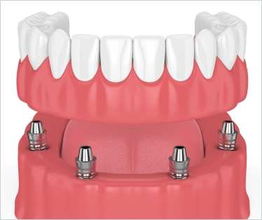 Sweet Smiles Family Dentistry — photo 4